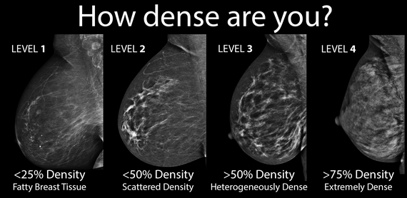 Mammogram vs. Thermogram vs. Other – Thermography Advantage